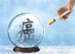 雅安恒博医院HPV检测技术，开启宫颈癌筛